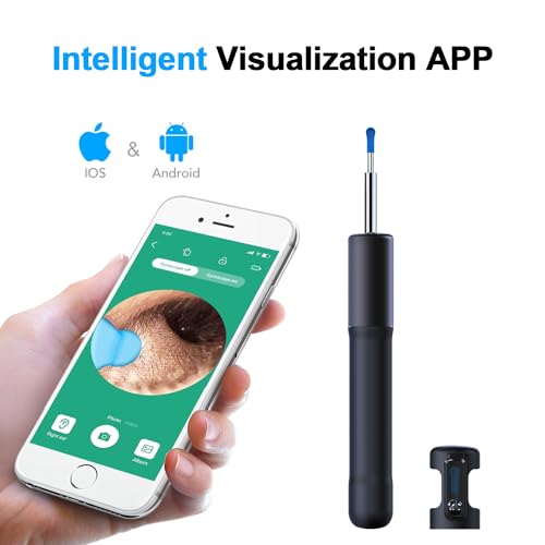 1080P HD Camera Ear Wax Removal Tool with Light A48780